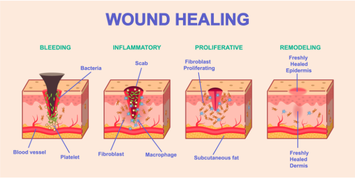 wound healing process illustration